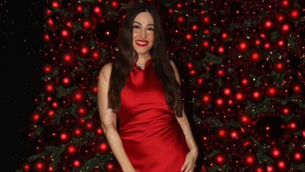 Ιωάννα Παλιοσπύρου: Συνεχίζει επεμβάσεις στο Λονδίνο