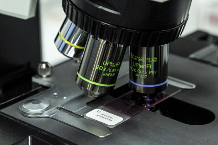 επιδημία μηνιγγίτιδας πανεπιστήμιο Κεντ Βρετανία εμβολιασμός