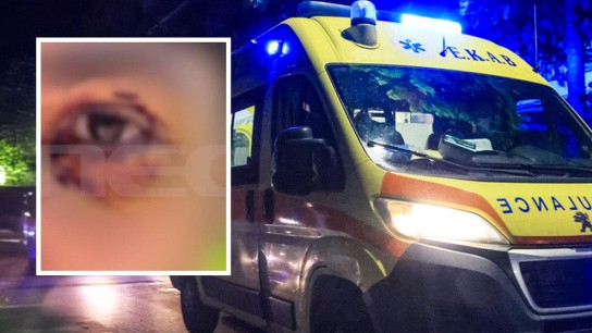 Επίθεση ανηλίκων στα Ιωάννινα: 16χρονος κινδύνευσε να τυφλωθεί επίθεση ανηλίκων Ιωάννινα 16χρονος τραυματισμός μάτι