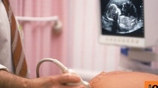 Απαγόρευση αμβλώσεων Γουαϊόμινγκ καρδιακό παλμό