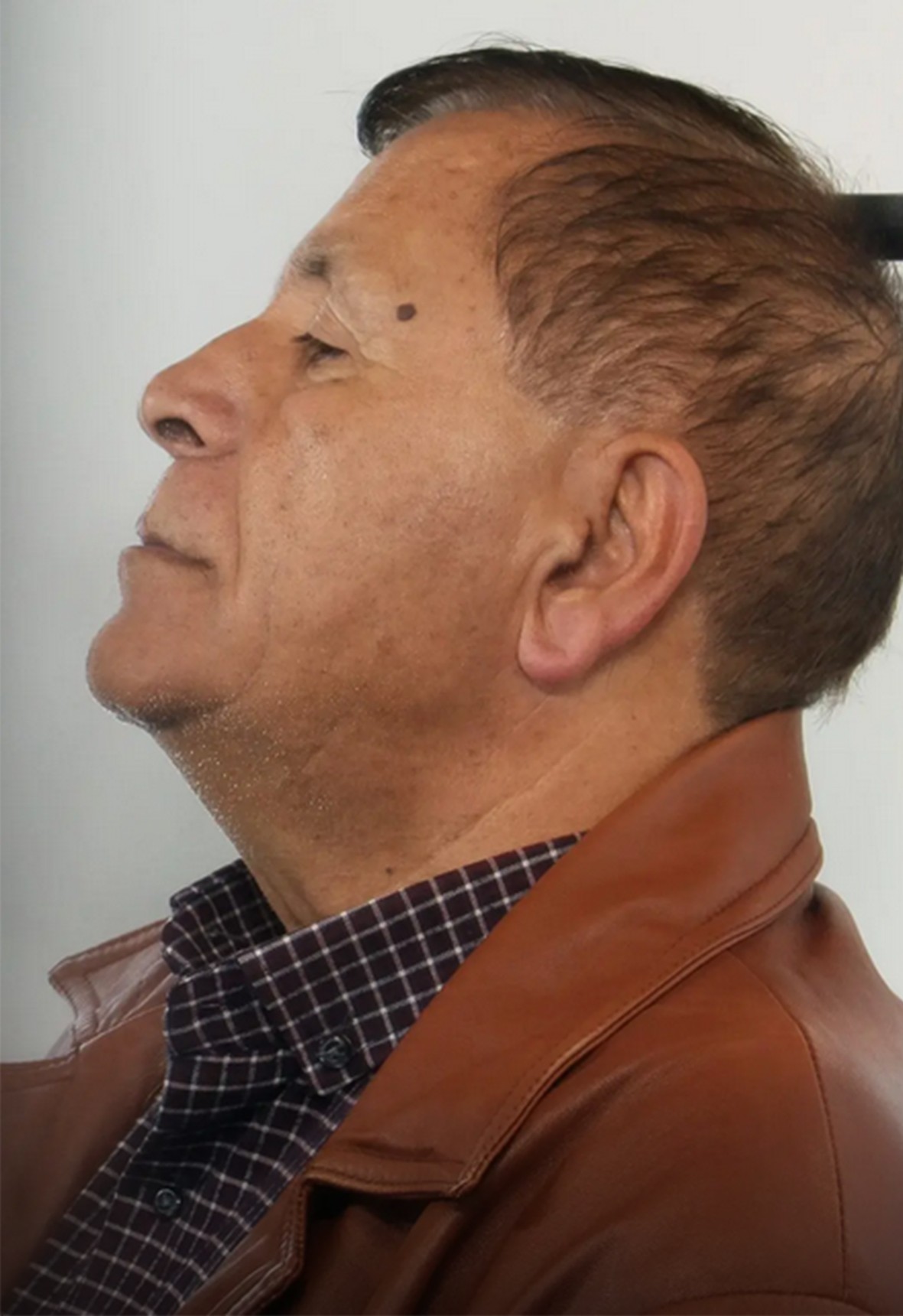 απάτες ηλικιωμένων Αττική 70χρονος σύλληψη